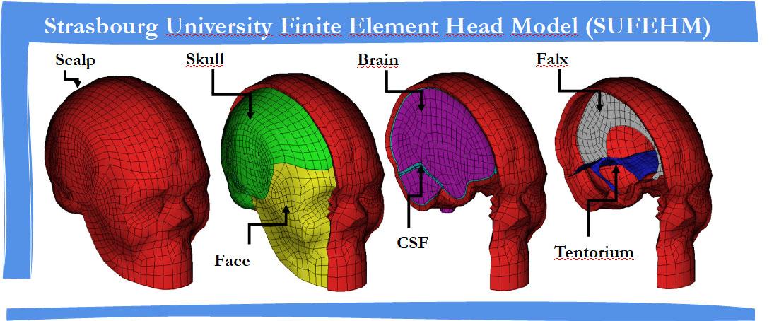 Modèle mécanique du cerveau utilisé pour calculer les contraintes intracérébrales lors d’un impact.